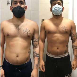 ANTES Y DESPUES
