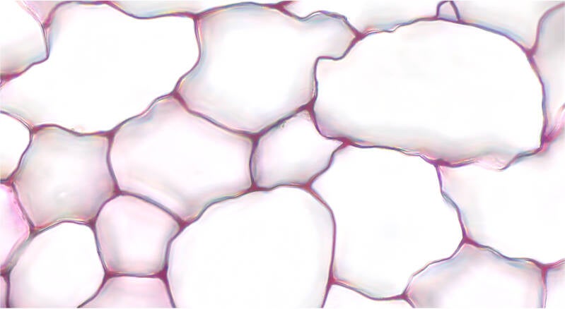 parenchyme polyédrique