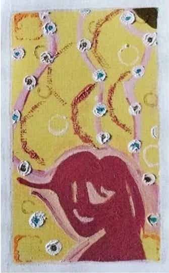 Everyone Needs Kisses (yellow)