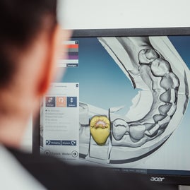 Moderne Technik, Cad/Cam