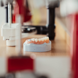 Implantat, Modellguss, Inlays, Brücke