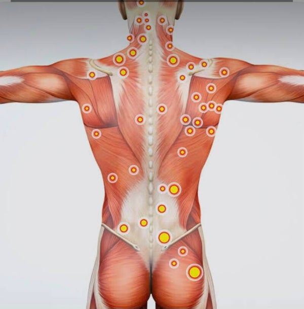 Triggerpoint massage