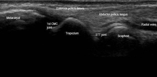Free RMSK Practice Quiz