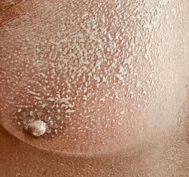 Dust