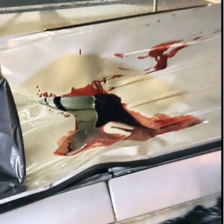 Selfmade blood in the selfmade Blood Transfusion Tube and on the car.  We used this blood and my selfmade BloodPump in the new Serie :     " BESTSELLERBOY "  made by Lisa Schekkerman