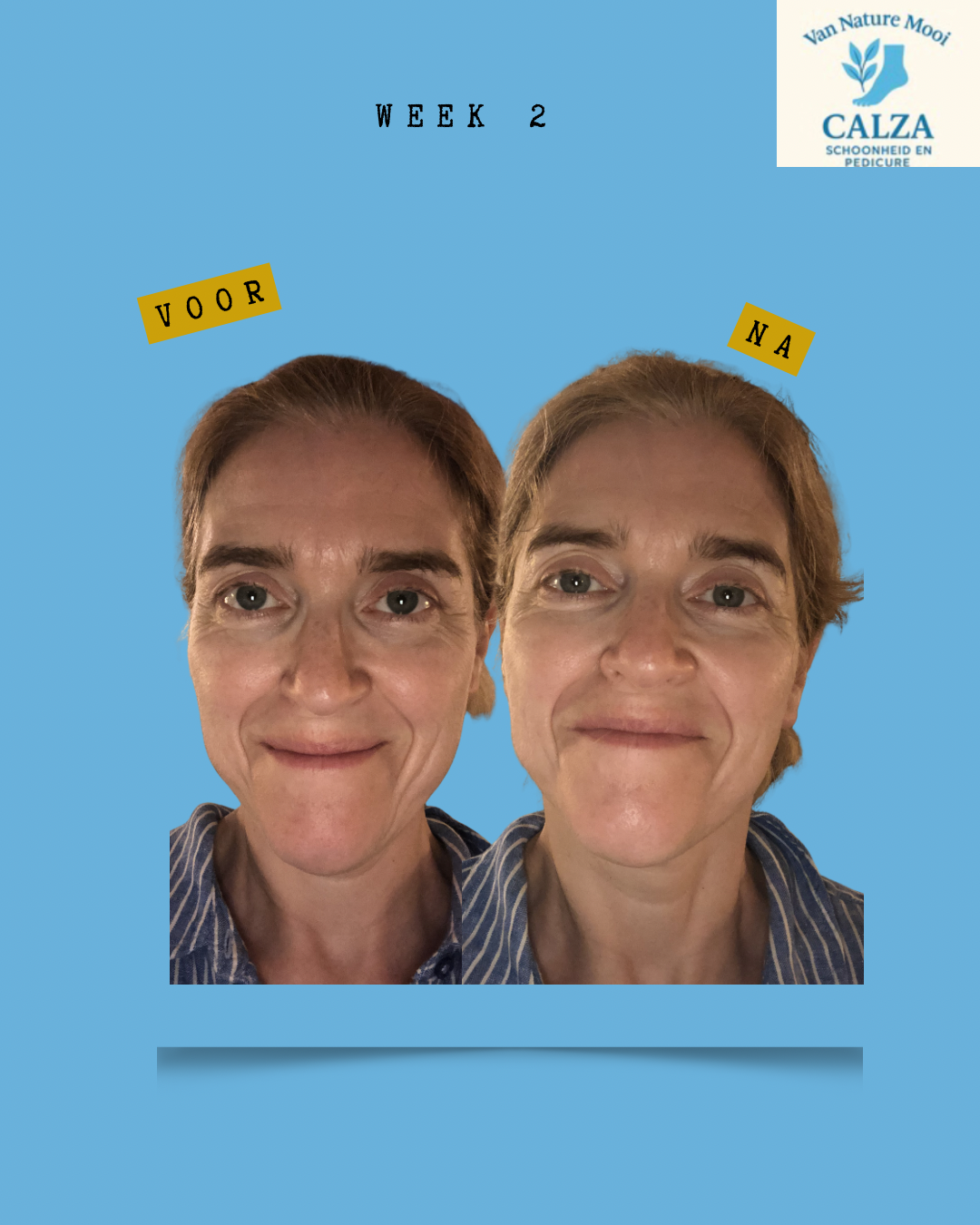 kopie-van-gray-minimalist-before-and-after-skincare-instagram-story-instagram-bericht-45-standard-41ju4x.png