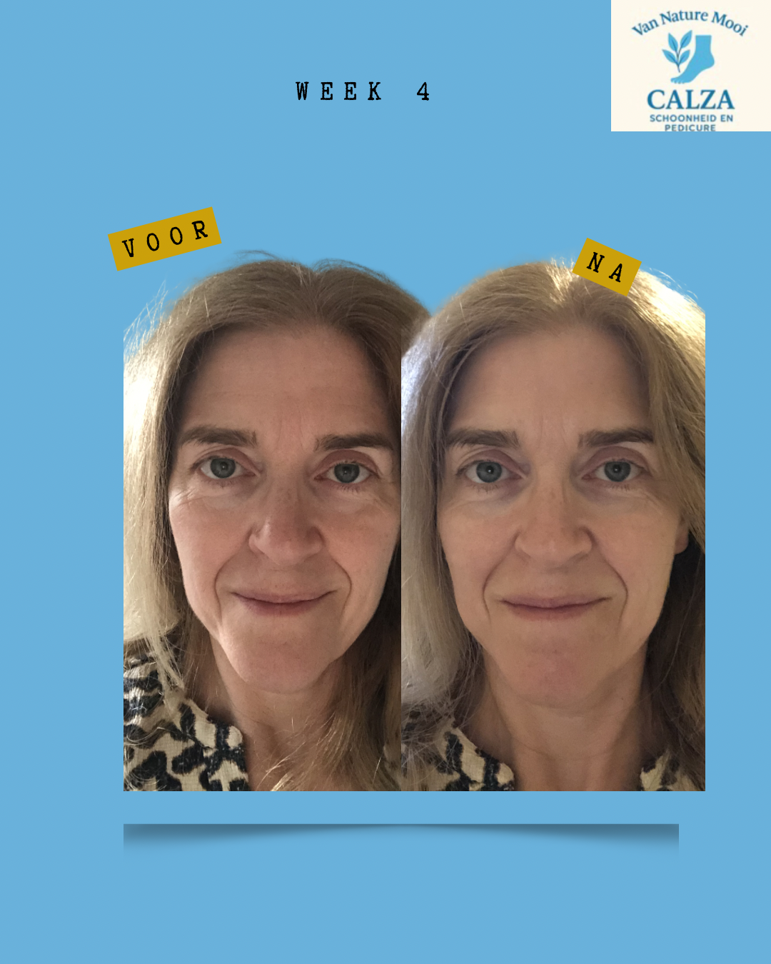 kopie-van-gray-minimalist-before-and-after-skincare-instagram-story-instagram-bericht-45-standard-5wrgen.png