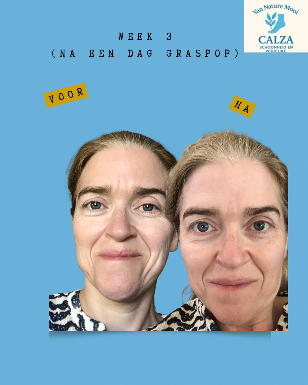 kopie-van-gray-minimalist-before-and-after-skincare-instagram-story-instagram-bericht-45-standard-85r01g.png