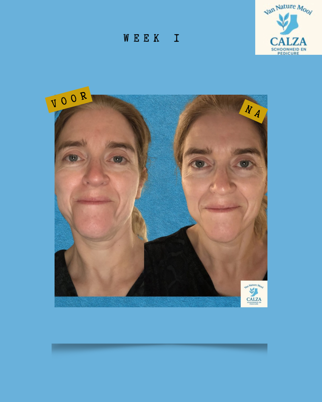 kopie-van-gray-minimalist-before-and-after-skincare-instagram-story-instagram-bericht-45-standard.png