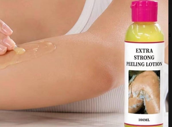 Peeling lotion