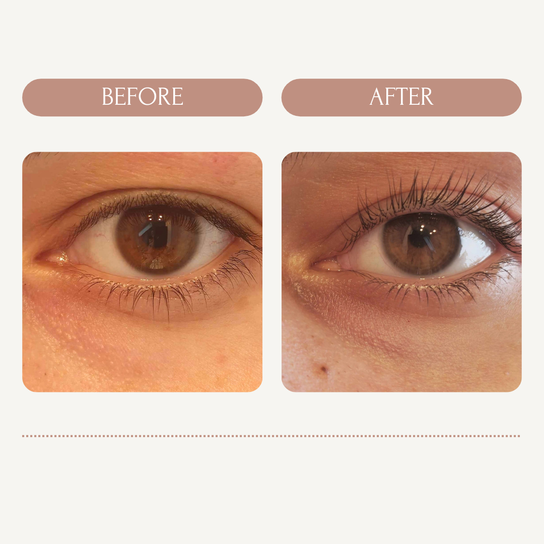 instagram-post-before-after-cosmetology_20241112_214726_0000-standard.png