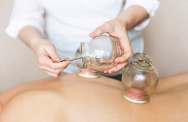 Cupping
