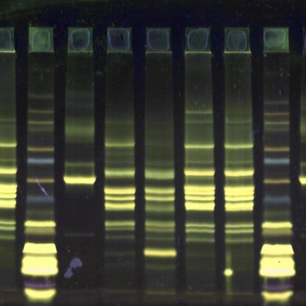 SDS Urinary Protein Kit Gradient 52S