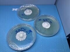 Plates : Culture on Agar