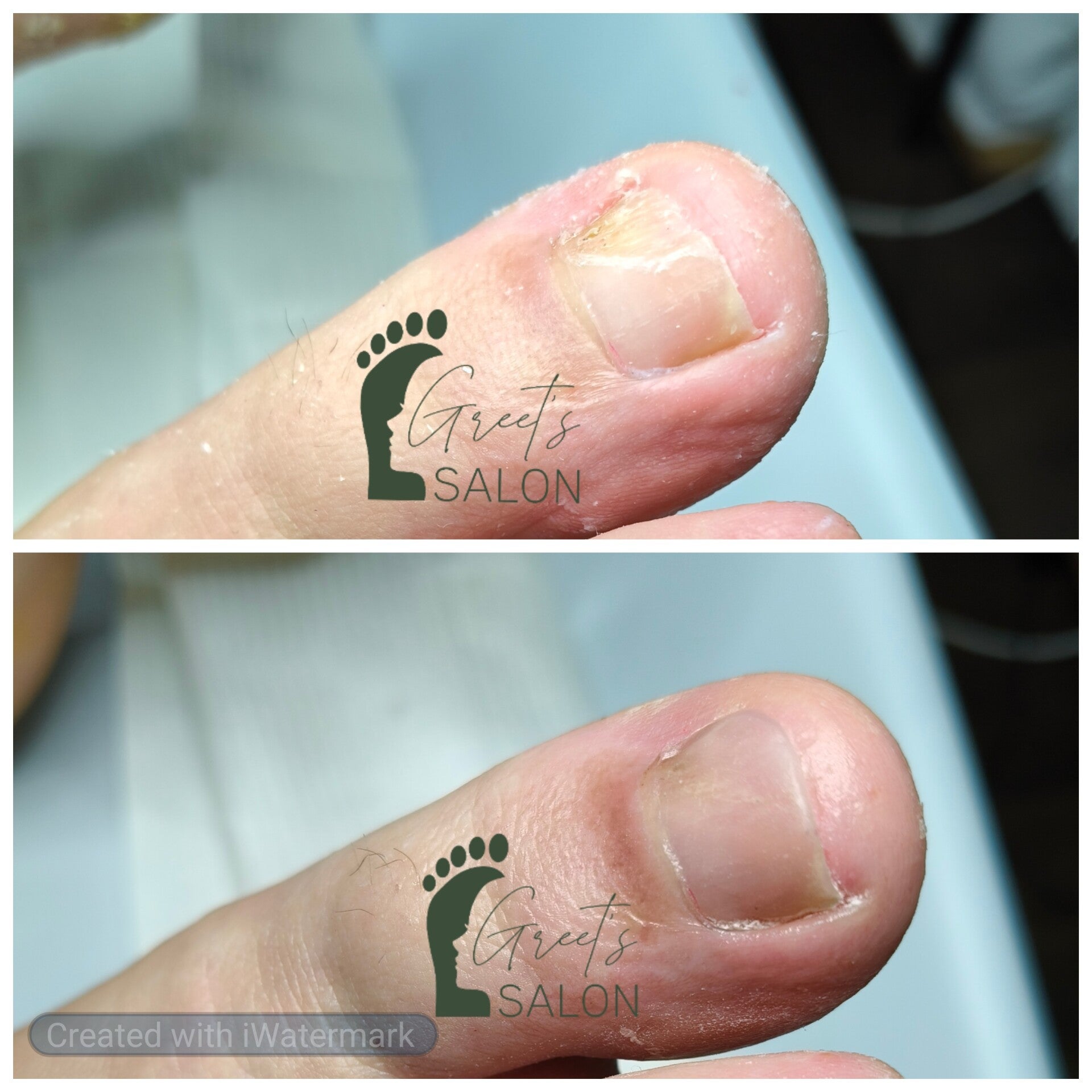 Nagelreparatie, medisch pedicure, renswoude, greet's salon, lunteren, barneveld, scherpenzeel, woudenberg