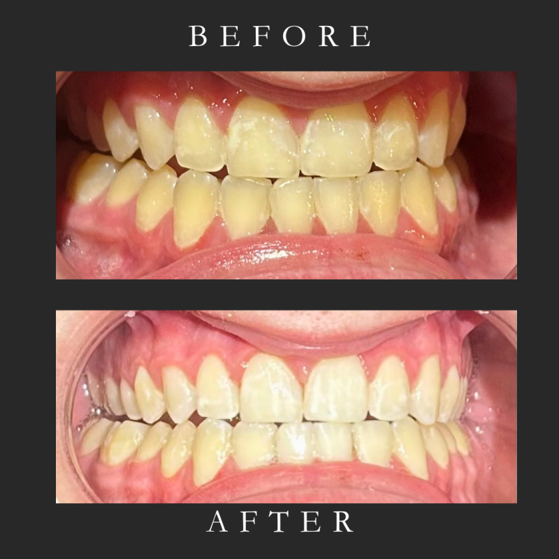 before-after-minimal-skincare-instagram-post-zip-1-standard.png