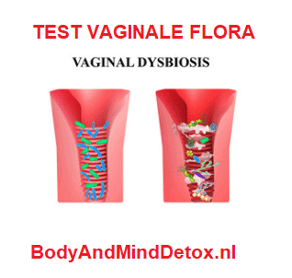 Vaginale Flora Analyse