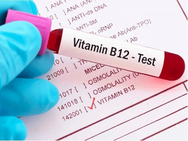 B 12 tekort gerelateerde testen