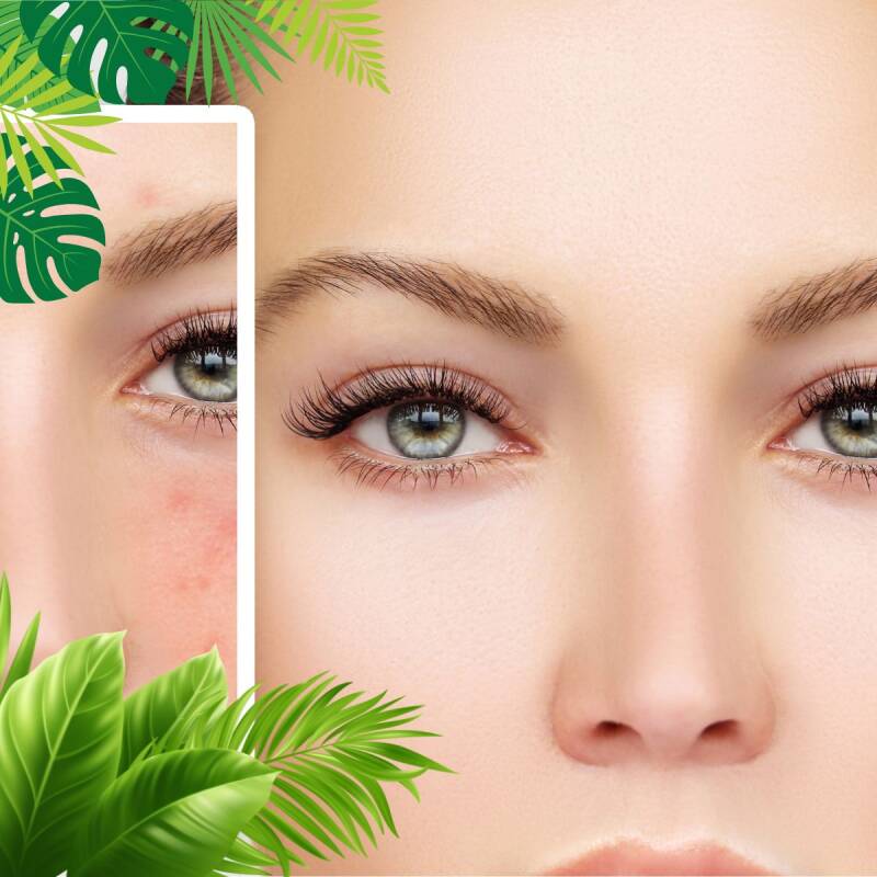 „Reine Haut bekommen durch zelluläre Regeneration und Anti-Aging – Vorher-Nachher Vergleich einer strahlenden Frau umgeben von tropischen Blättern aus Costa Rica.“