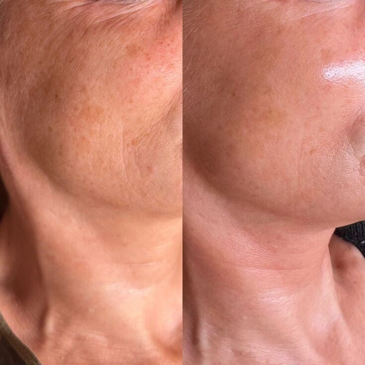 schoonheidssalon schoonheidsstudio schoonheidsspecialiste nagelsalon nagelstudio nagelstyliste gelaatsverzorging gelaatsverzorgingen luxe gelaatsverzorging dermaplaning aquafacial hydrodermabrasie wimperlifting wenkbrauwstyling nagels biab gellak gelnagel