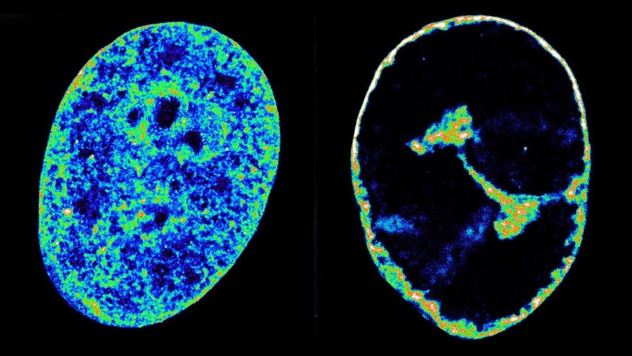 Un virus capable de remodeler notre ADN en 8 heures ? Une découverte qui fait trembler les fondations de la biologie cellulaire