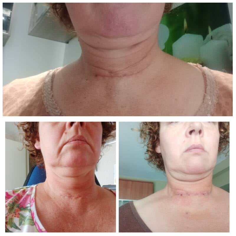 long covid | long covid | long covid | long covid | long covid | long covid | long covid | long covid | long covid | long covid | long covid | long covid | long covid | long covid | long covid | long covid | long covid | long covid | long covid | long cov