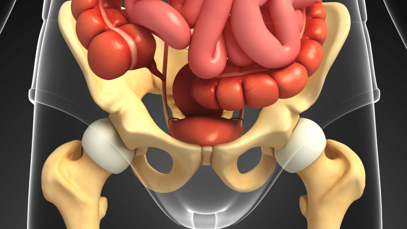 verzakking. orgaan verzakking. baarmoeder verzakking. bekken. darm verzakking. vagina verzakking.