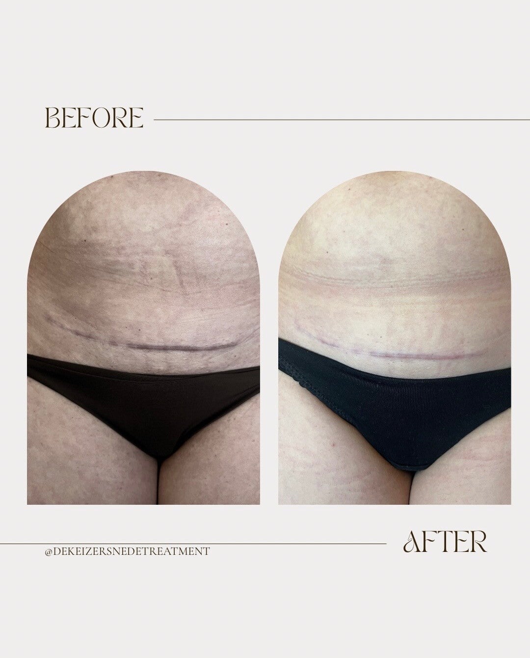 minimalist-transformation-before-after-instagram-story-standard-kkqbvj.jpg