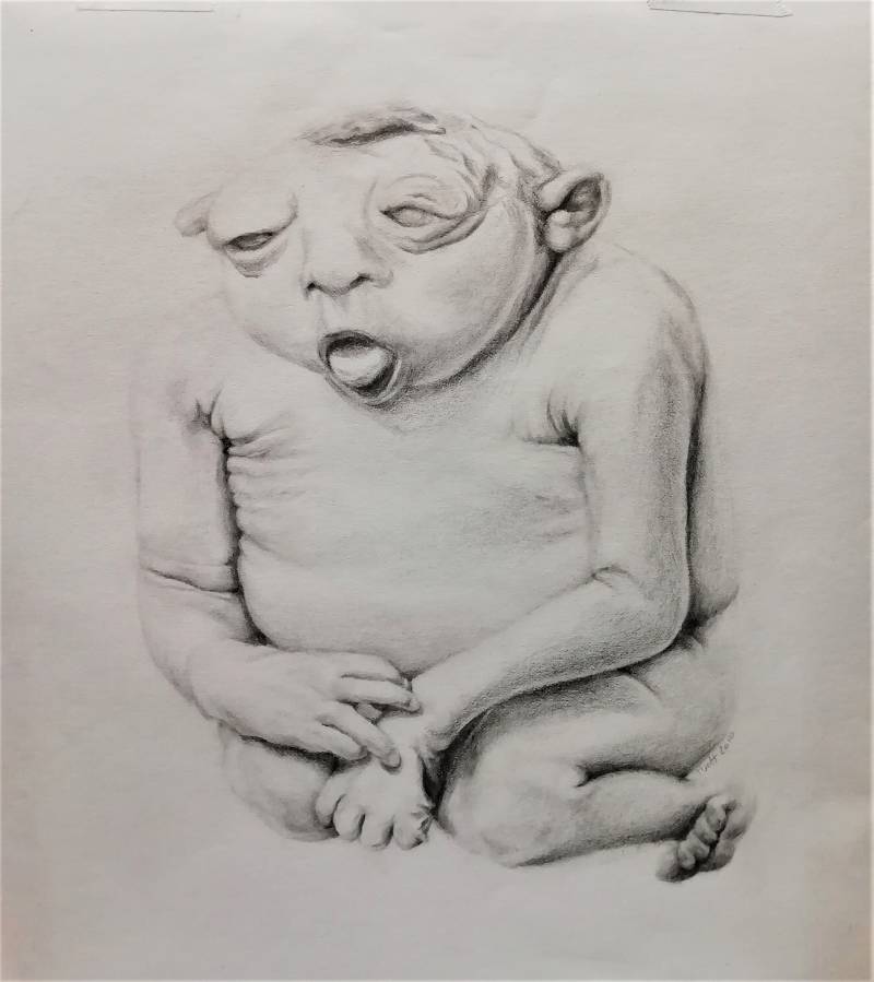 Anencefalie. Pencil on paper, 23x23 cm. incl. frame,  €230