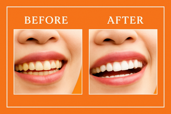 Deluxe Whitening Treatment (60 minutes)