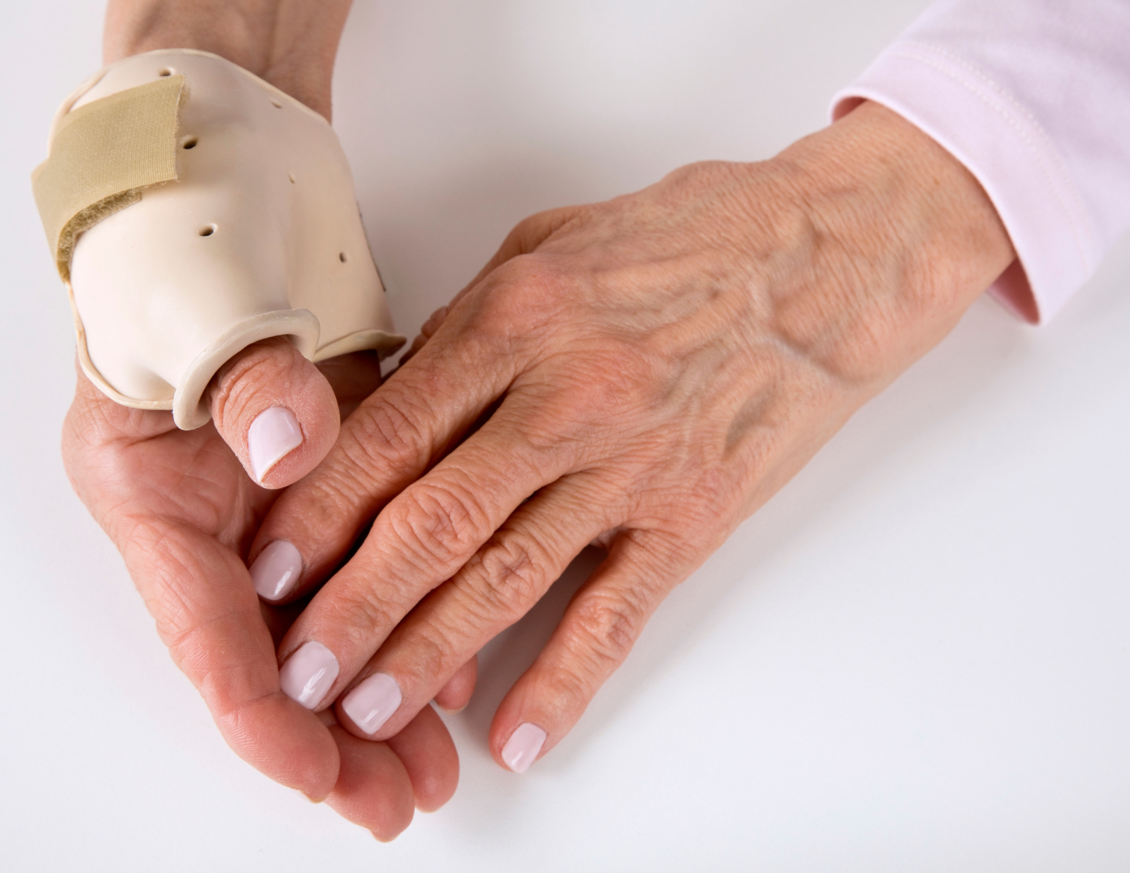 splinting, thermoplastic splint, thumb in the splint