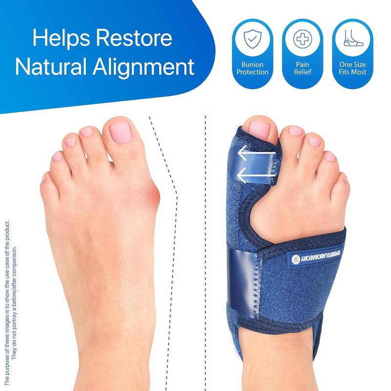 Hallux valgus brace en nachtspalk. Voor een zo goed mogelijke correctie van je hallux valgus.