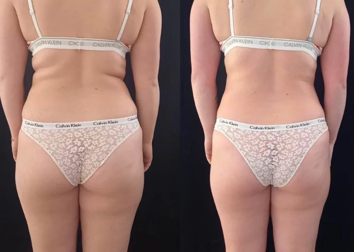 resultat_active_wrap_02-standard.webp