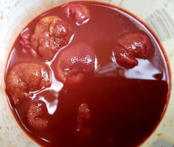 LIVER