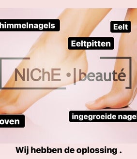 Schimmelnagel, eeltpitten, eelt, ingegroeide nagels, kloven hebben geen geheimen bij Niche.