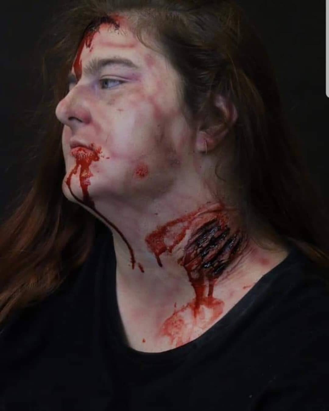 Custom Silicone Prosthetic