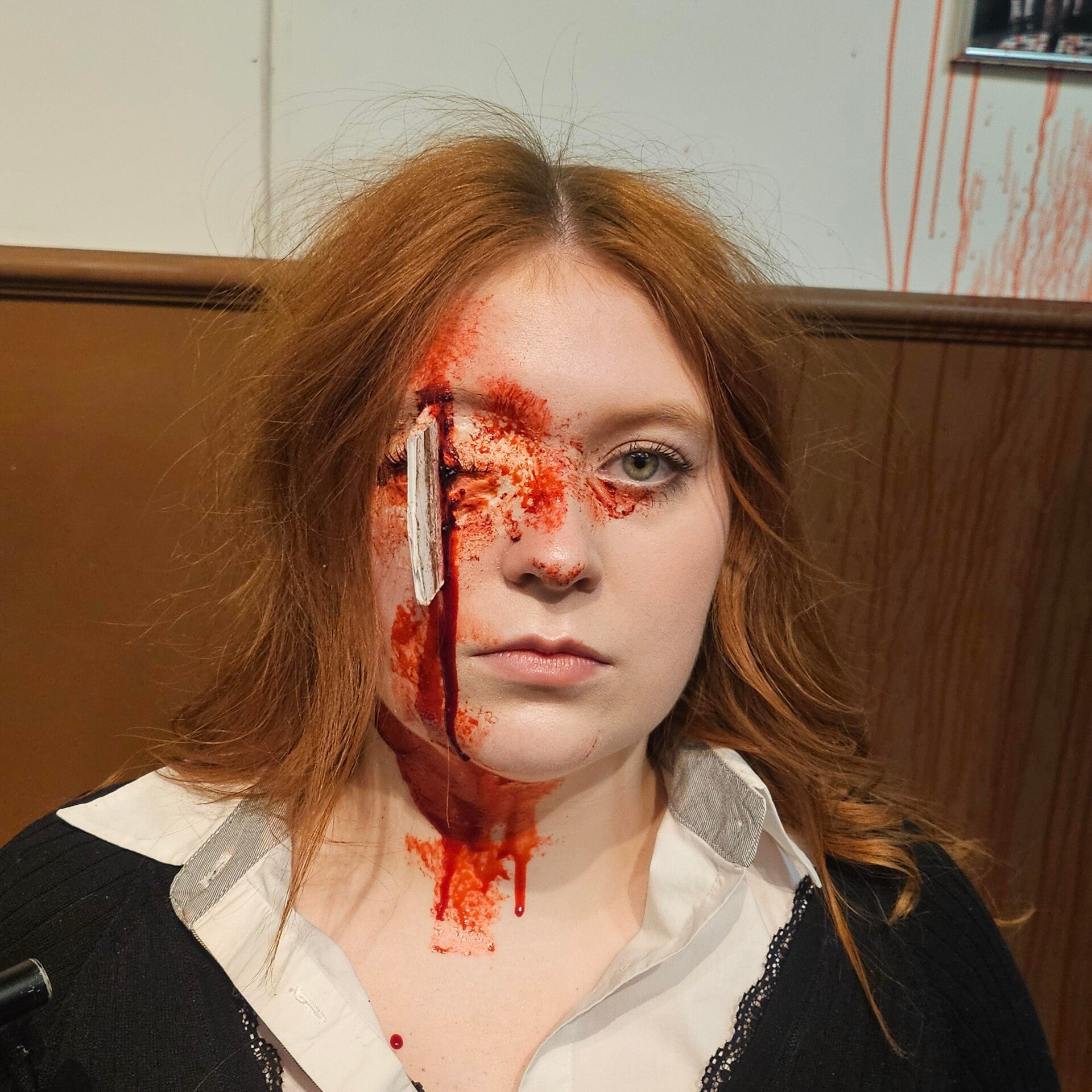 Eye wound