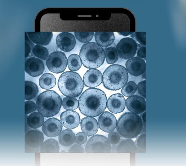 Alteraciones de las vías de señalización celular en el cáncer
