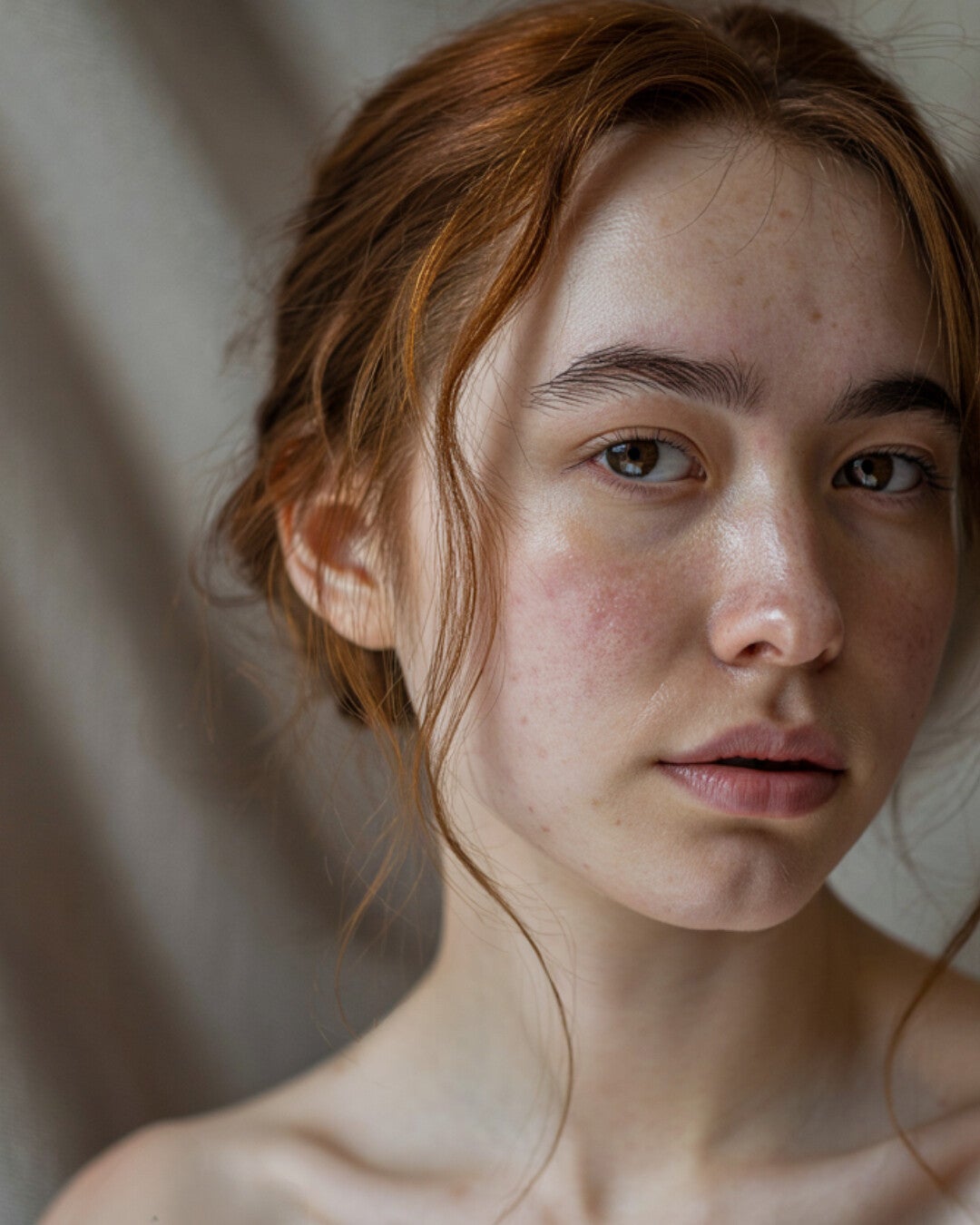 Skinblog - huidprobleem of gemiste signalen?