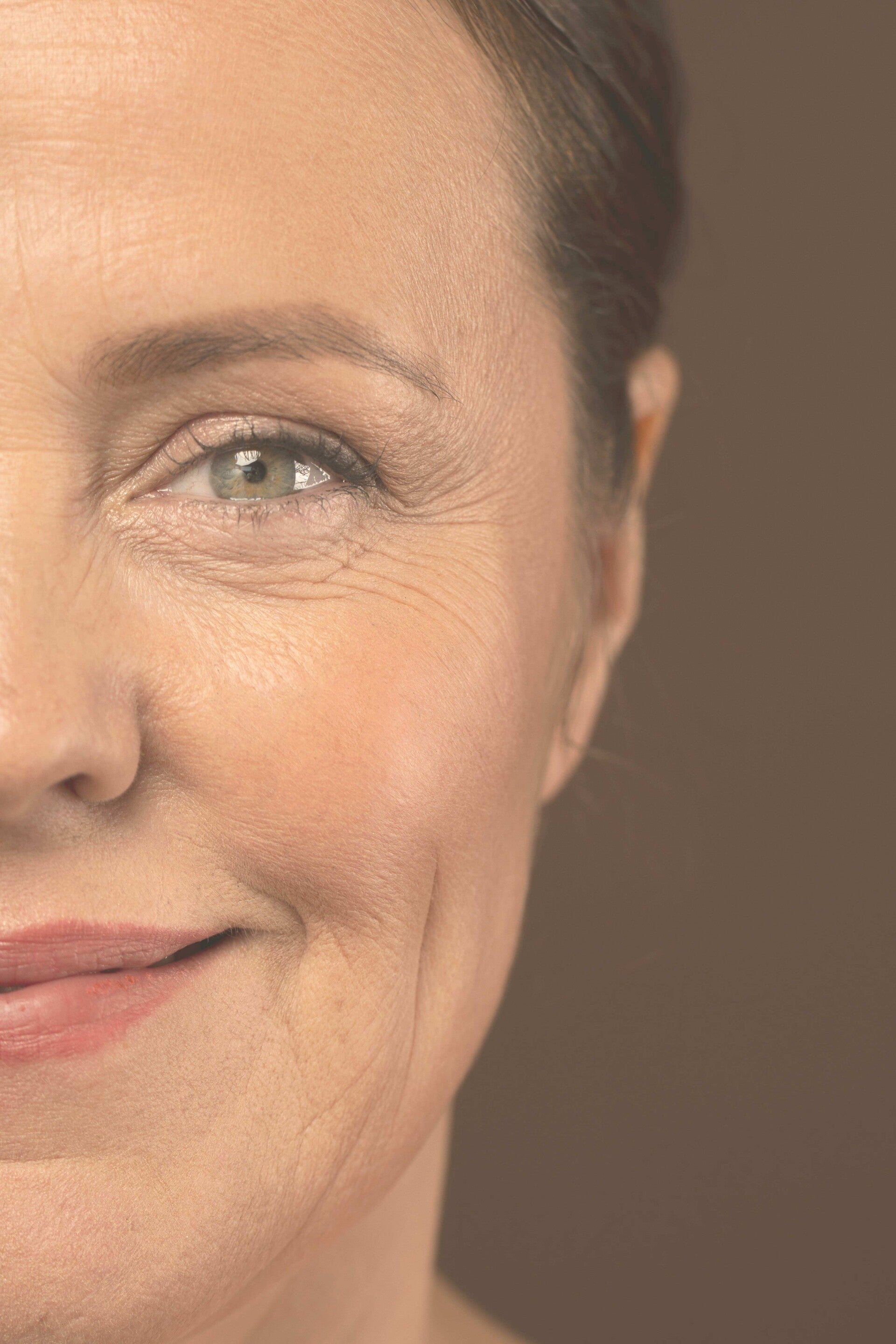 Arrugas,medicina estética