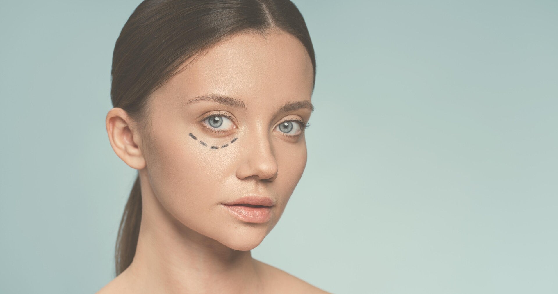 Blefaroplastia, medicina estética