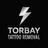 Torbay Tattoo Removal