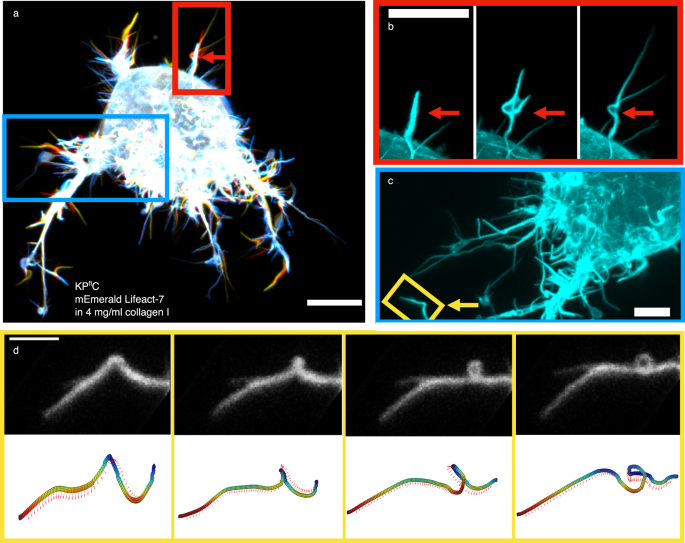 Confocal 3D images showing how individual filopodia from pancreatic cancer cells rotate, twist and perform beautiful buckles.