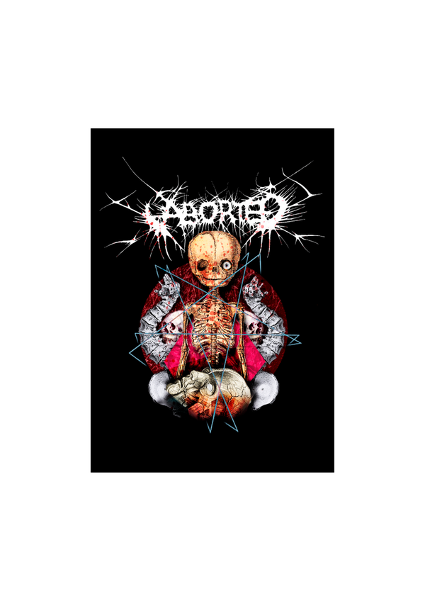 Aborted 4 Music Print  Concert Wall Art Memorabilia gift A5,A4,A3