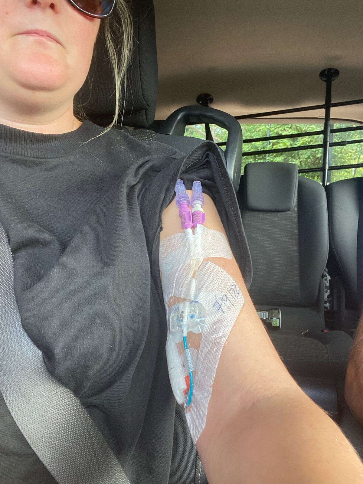 Life after stoma reversal and the next plan Mypainintheassblog