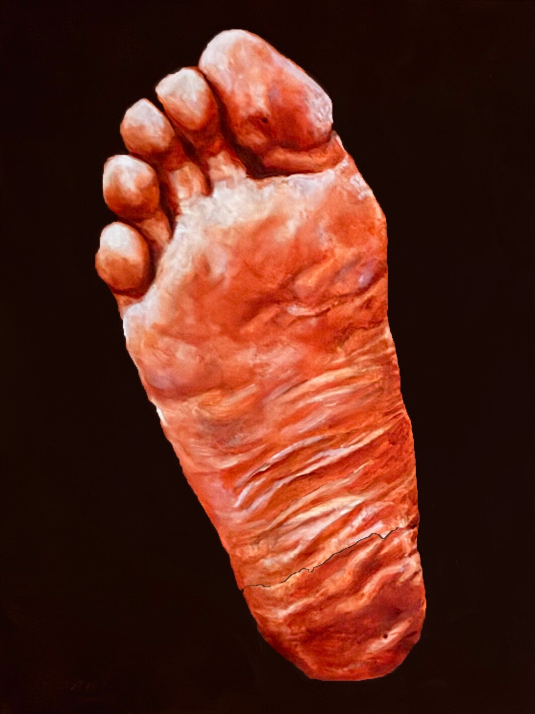 His right foot