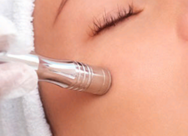 HIGIENE FACIAL CON PUNTA DE DIAMANTE (DIAMOND PEEL)