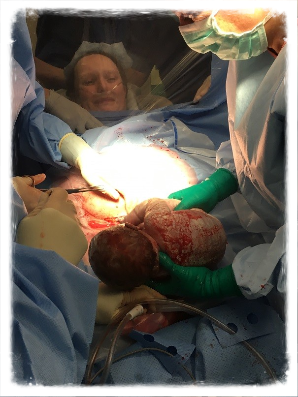 doula Sonja Zantinge samenwerking met Ropcke Zweers Ziekenhuis keizersnede 