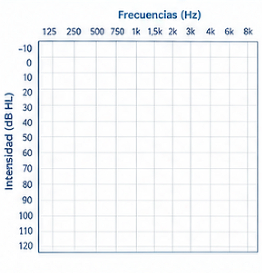 Audiograma en blanco