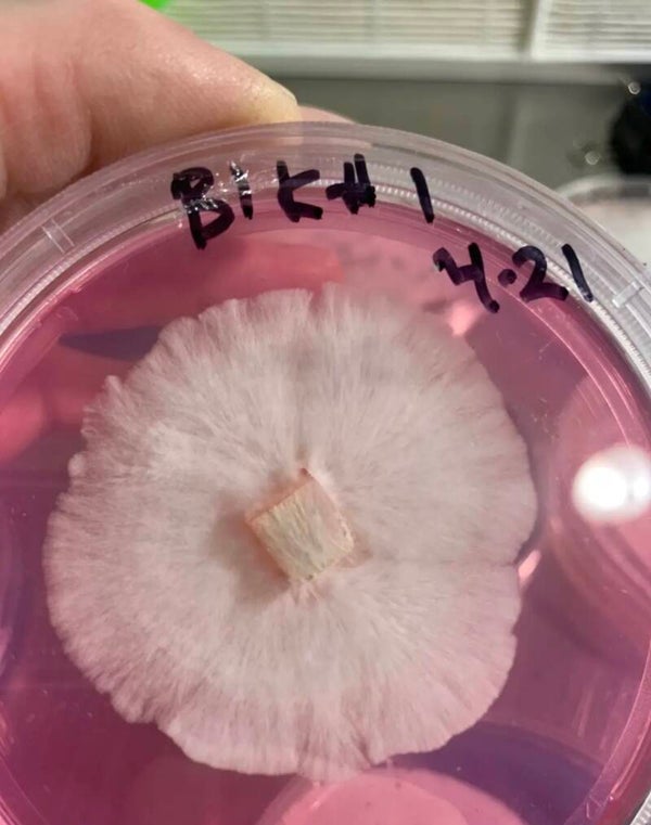 Agar Plate